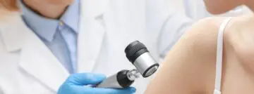 AI spoort huidkanker op: is het een kwaadaardig vlekje of niet?